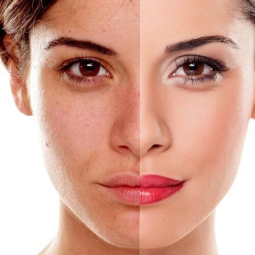 Pigmentation Facial(60 minutes)